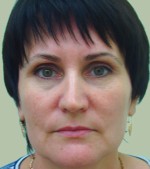 До процедуры