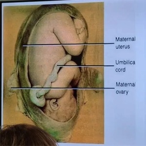 Аурикулотерапия